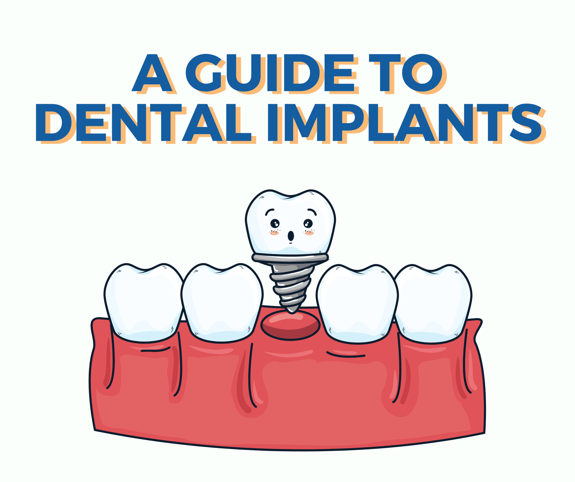 Dental Implants